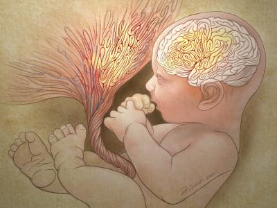 Abnormal Placental Folds Signal Autism Risk at Birth