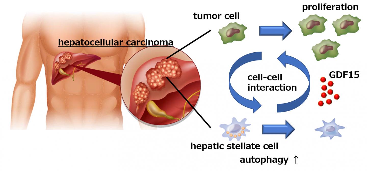 Stem Cells and Cancer in Hepatology: Yun-Wen Zheng · | Books Express Cancer hepatic cells