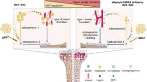 Schematic diagram showing adipocyte ESRRA deﬁciency preserves osteogenesis and vascular formation in adipocyte-rich bone marrow via oppositely modulating lepin and SPP1.