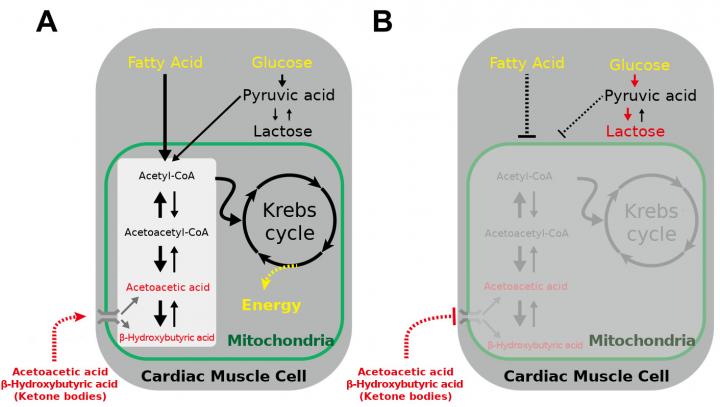 Changes of Ketone Body Utilization States in the Heart