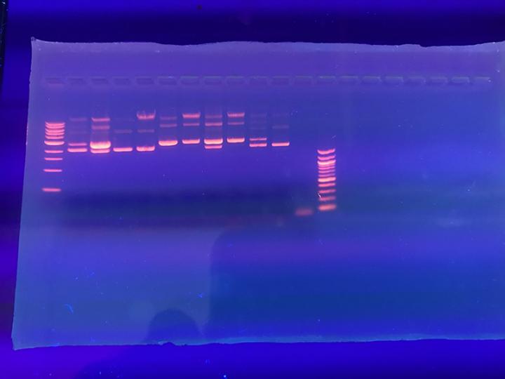 Electrophoresis gel