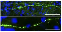 Mild Traumatic Brain Injury Induces Axonal Varicosities in Mice