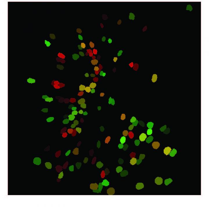 Brain Activity Patterns