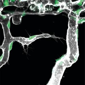 Image of active pioneer cell (center of image). Green indicates endothelial cell nucleus, grey the outline of the blood vessels. (Photo: Zoological Institute, KIT)