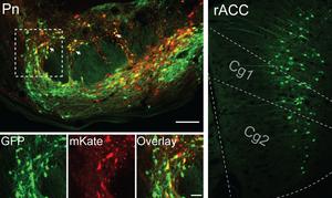 Neuroscience of Placebo Effect