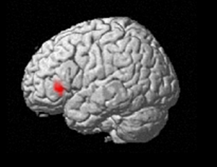 Inferior frontal gyrus (red dot), a region of the brain’s frontal lobe that controls eating behavior