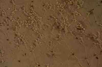 Multi-Walled Carbon Nanotubes-Ethylenediamine-Nerve Growth Factor Complexes