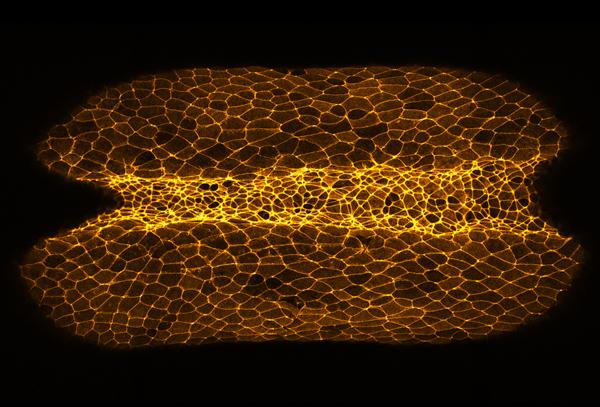 Neuroepithelial Cells Undergoing a Shape Change in <i>Xenopus laevis</i> Embryo