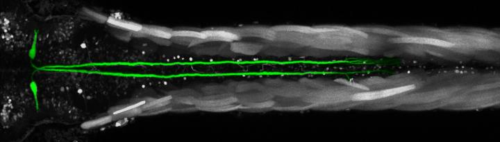 Mauthner Cells Image Eurekalert Science News Releases