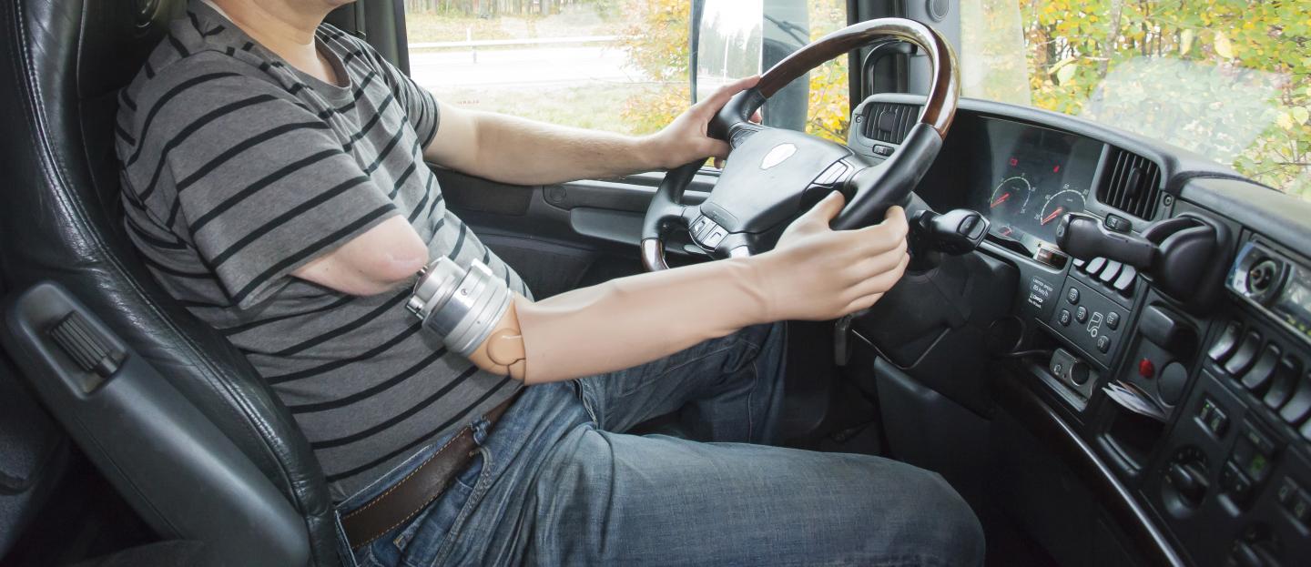 Driving with an Osseointegrated Prosthesis