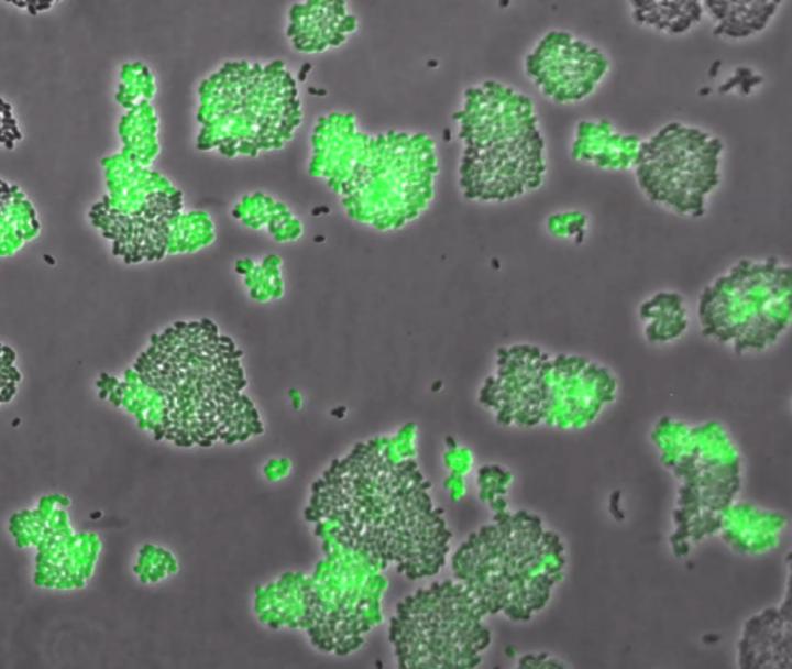 Single Cell Expression of the High-Affinity Methionine Transporter