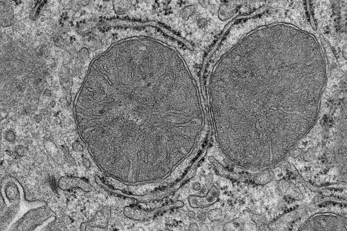 Mitochondria in the liver