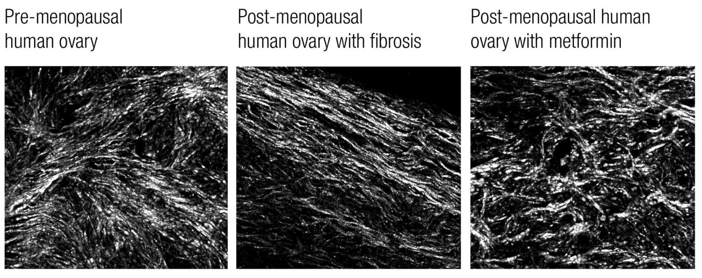 Fibrosis Develops with Age in the Ovaries