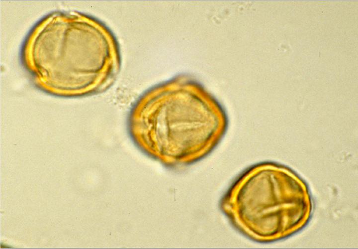 Pollen Under the Microscope (Three Grains)