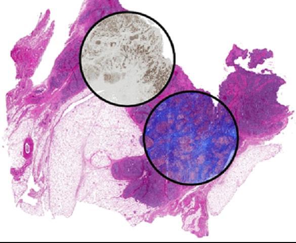 Breast Tissue is Stained to Show Hematoxylin and Eosin (Large Tissue Section).