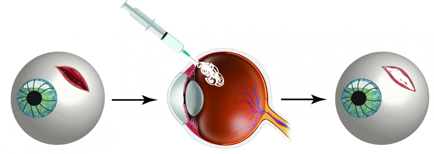 A Heat-Activated Glue Mends Eye Injuries on Demand (1 of 2)