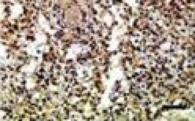 Immunohistochemical Assay 