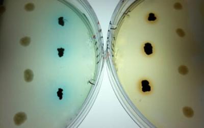 Colonies of Superoxide-Producing Bacteria Growing on Laboratory Plates with Dye