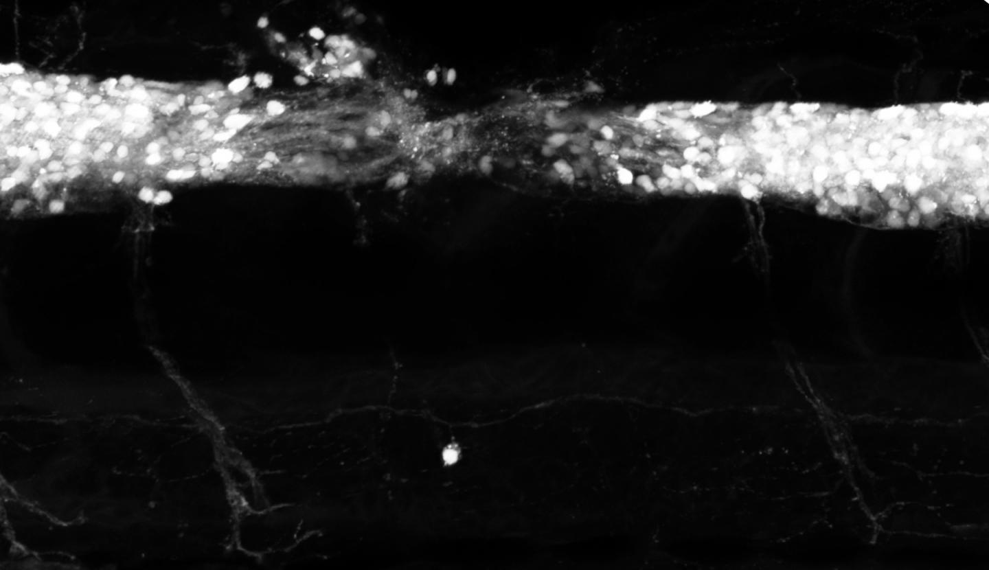 New, rapid CRISPR/Cas9 method identifies key genes in zebrafish spinal cord regeneration