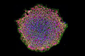 Pluripotent stem cells