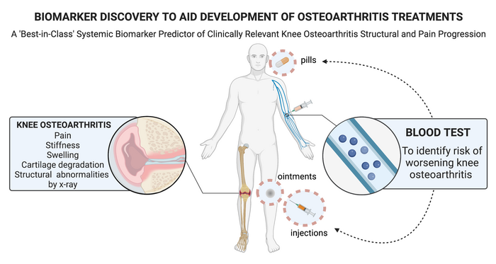 BIOMARKER DISCOVERY TO AID DEVELOPMENT OF OSTEOARTHRITIS TREATMENTS