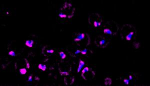 Protein condensates