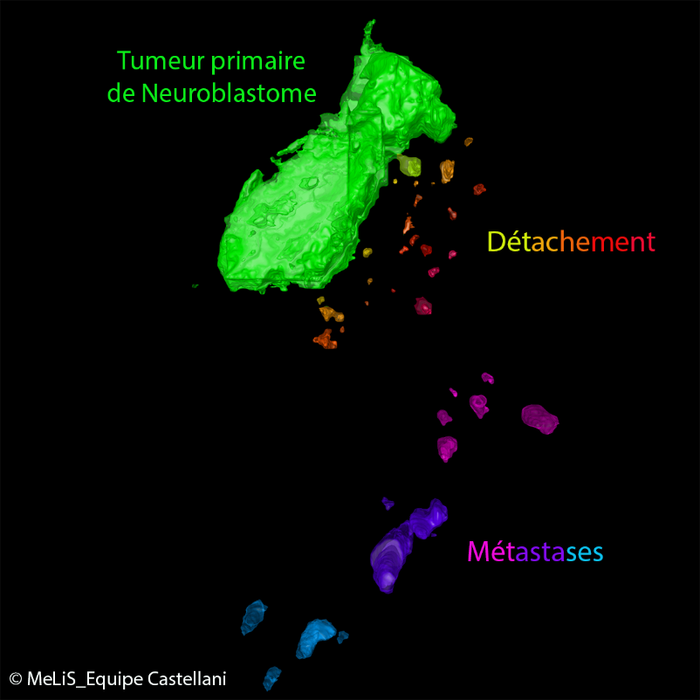 Modélisation du neuroblastome dans l’embryon aviaire.