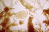 A Single Sheep Liver Fluke, <em>Fasciola hepatica</em>, Flatworm Ovum