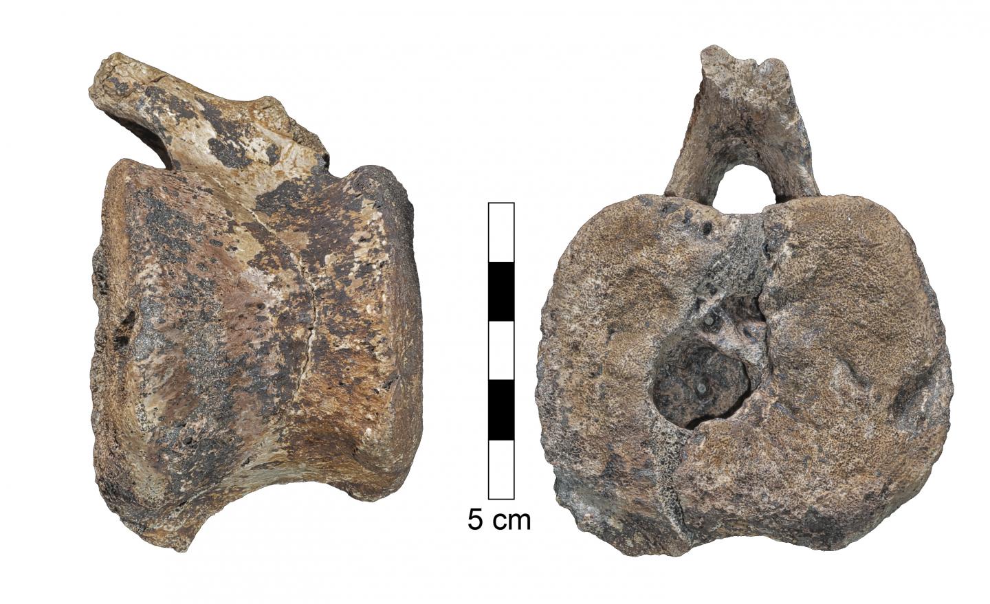 human caudal vertebrae