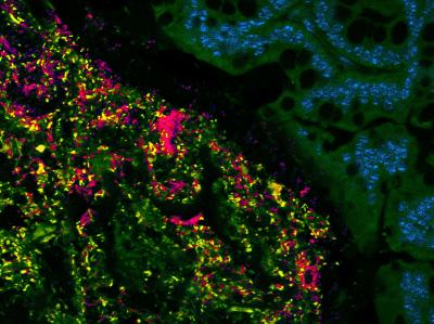 Symbiotic Microbes Colonizing the Colon