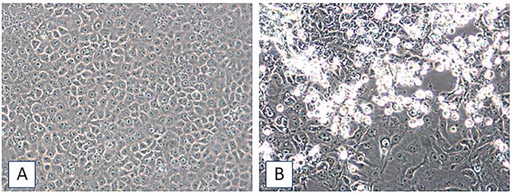 Madariaga Virus Spreads to Haiti