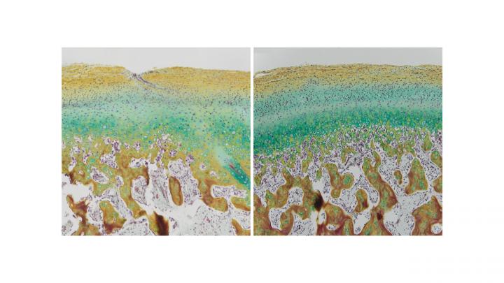 Stratification of the cartilage layer