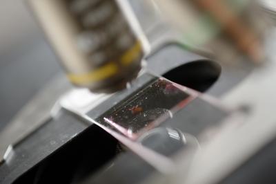 A Breast Cancer Tumor up Close