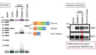 Cas3-Mediated DMD Exon Skipping