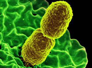 Klebsiella pneumoniae