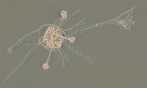 Infected bdelloid rotifer