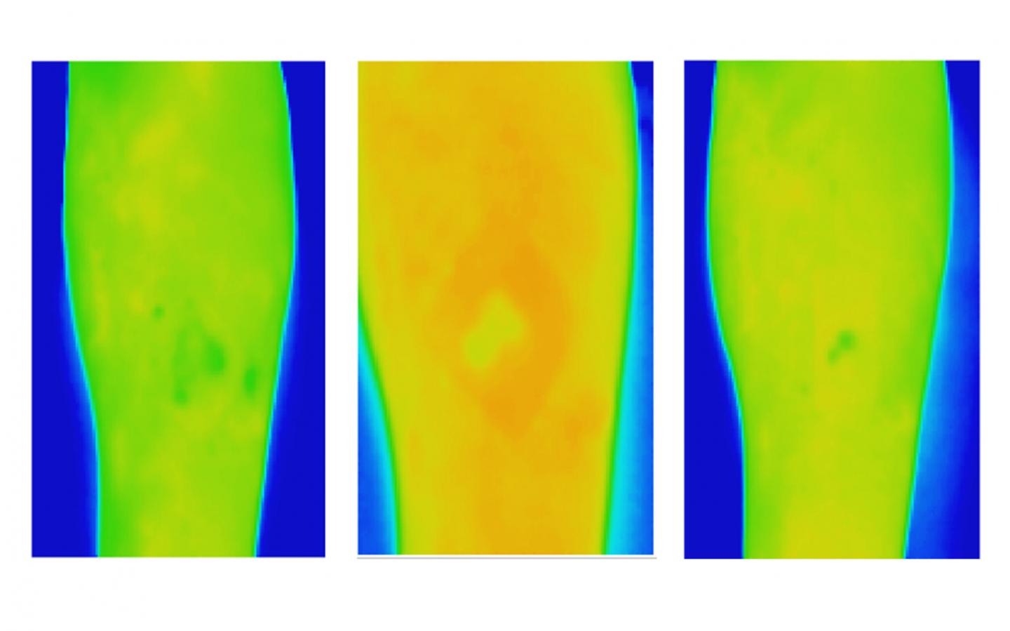 Thermal Imaging for VLU (Healed)