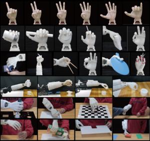 A lightweight prosthetic hand with 19-DOF  dexterity and human-level functions