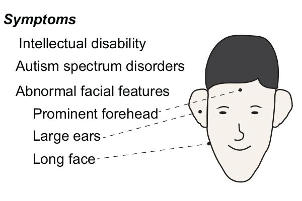 New Insights into Fragile X Syndrome and the Fetal Brain