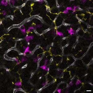 Macrophages in pituitary gland