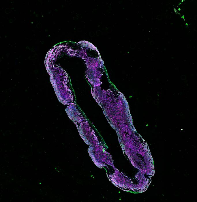 Engineered human heart muscle tissue