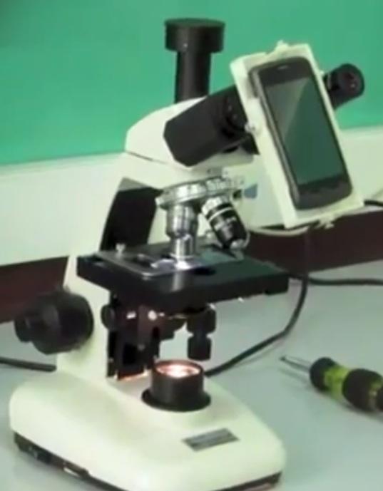 Combining Mobile Phones with 3-D Printed Microscope Adapters to Diagnose Infectious Diseases