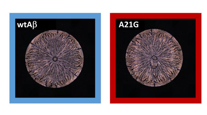 Sieci neuronowe mogą wykrywać subtelne różnice we wzorcach barwników z wysuszonych roztworów peptydów (po lewej: peptyd amyloidu-beta (Aβ42); po prawej: mutacja).