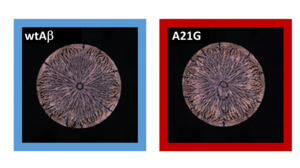 Neural networks can detect minute differences in the stain patterns from dried peptide solutions (left: amyloid beta (Aβ42) peptide; right: mutation).