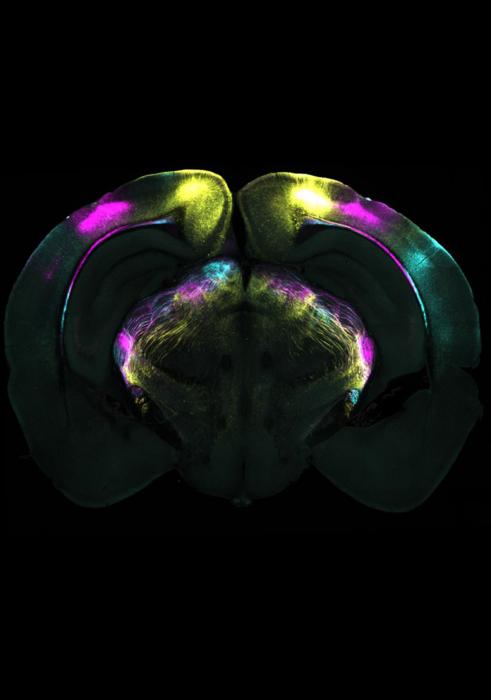 Brain slice showing projections to the vLGN