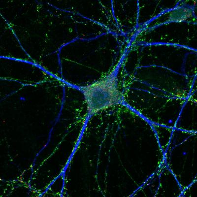 Neuron-Glia Coculture Stained for Neuronal Map2 and Pre- and Postsynaptic Proteins vGlut1 and Homer