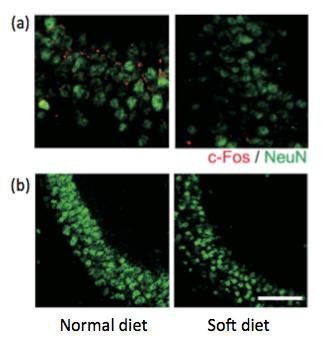 Image 2 Neuron Activity