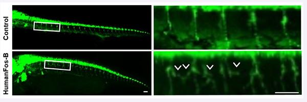 Researchers find a new pathological mediator of ALSResearchers Find a New Pathological Mediator of A