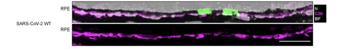 retina cells covid