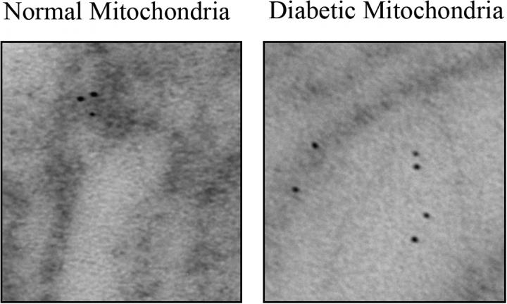 Mitochondrial Disruption